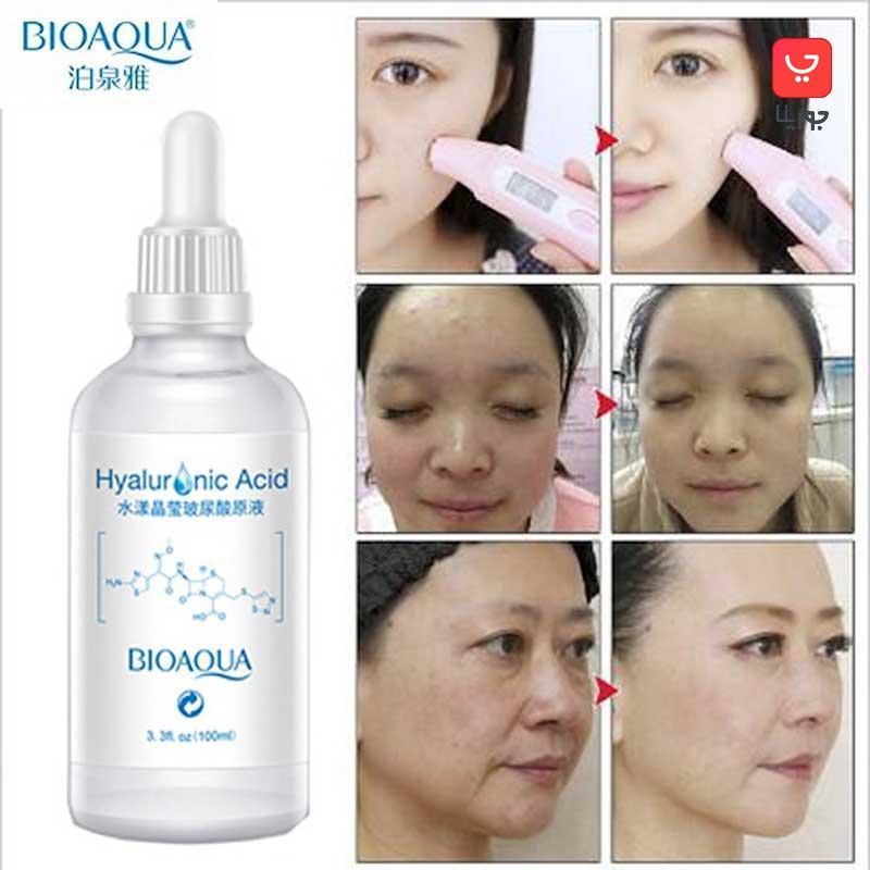 سرم هیالورونیک اسید بیوآکوا Bioaqua آبرسان و روشن کننده